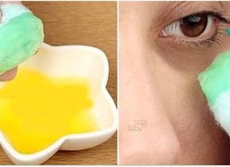 სახლის სამკურნალო საშუალებები თვალის ქვეშ არსებული მუქი წრეების გასაქრობად!