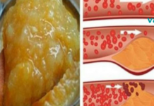 დაიწყეთ ამ პროდუქტის გამოყენება და დაივიწყეთ აბები! უთხარი არა ჰიპერტენზიას და მაღალ ქოლესტერინს!