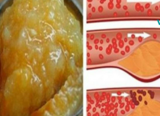 დაიწყეთ ამ პროდუქტის გამოყენება და დაივიწყეთ აბები! უთხარი არა ჰიპერტენზიას და მაღალ ქოლესტერინს!