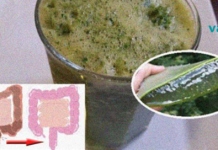 როგორ მოვიშოროთ სულ მცირე 9 კილოგრამი ნარჩენები მსხვილი ნაწლავიდან და დავტოვოთ იგი სრულიად ცარიელი!