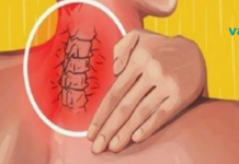 6 მარტივი ვარჯიში, რომელიც სწრაფად მოგიხსნით კისრის ტკივილს!