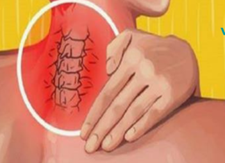 6 მარტივი ვარჯიში, რომელიც სწრაფად მოგიხსნით კისრის ტკივილს!