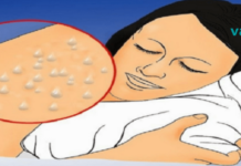 ღამით ოფლიანობა შესაძლოა საკმაოდ სერიოზული პრობლემის მიზეზი იყოს – თუ ეს პრობლემა გაწუხებთ, სასწრაფოდ მიმართეთ ექიმს!