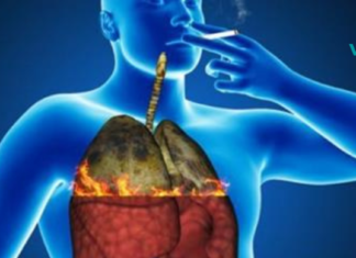 ფილტვების გამწმენდი სასმელი, რომელიც ყველამ, ვინც ეწევა ან არ ეწევა მაინც უნდა სცადოს..