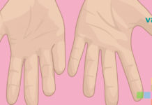 სისხლის ცუდი ცირკულაციის გამაფრთხილებელი ნიშნები, რომლებიც ჯანმრთელობის სერიოზულ პრობლემებს იწვევენ..