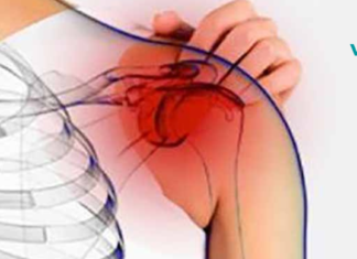 ბუნებრივი მკურნალობა “შებოჭილი” მხრისთვის და როგორ განვკურნოთ ის სწრაფად ..?!