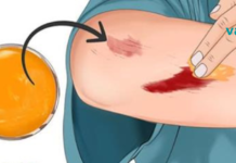 კურკუმას 5 დადასტურებული სარგებელი კანისთვის!!.. ისარგებლეთ ამ ინგრედიენტით