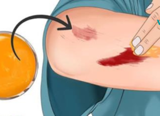 კურკუმას 5 დადასტურებული სარგებელი კანისთვის!!.. ისარგებლეთ ამ ინგრედიენტით