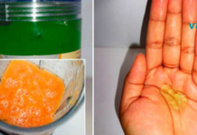 თუ გაწუხებთ კუჭის პრობლემები და მისგან გამოწვეული დისკომფორტი, მაშინ დალიეთ 1 ჭიქა ეს საშუალება და ის 1 საათში გაქრება!