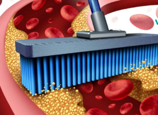 როგორ გავასუფთავოთ სისხლძარღვები ქოლესტერინისგან სახლის პირობებში..?!