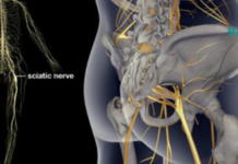 3 სავარჯიშო თეძოს და ზურგის ტკივილის სამკურნალოდ. სასარგებლო ინფორმაცია!