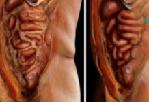 მოიშორეთ ორგანიზმიდან ყველა ცხიმი და პარაზიტი ამ 2 ინგრედიენტის გამოყენებით!