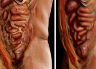 მოიშორეთ ორგანიზმიდან ყველა ცხიმი და პარაზიტი ამ 2 ინგრედიენტის გამოყენებით!