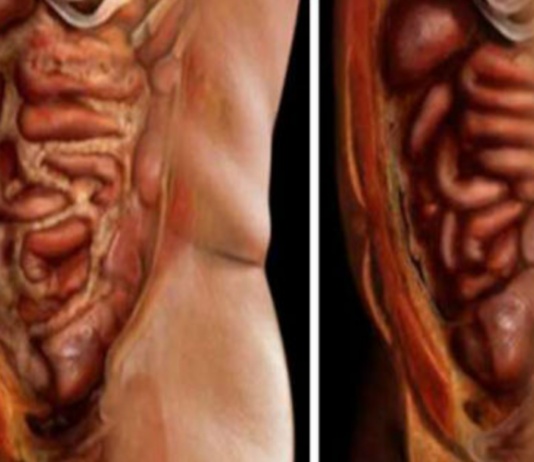 მოიშორეთ ორგანიზმიდან ყველა ცხიმი და პარაზიტი ამ 2 ინგრედიენტის გამოყენებით!