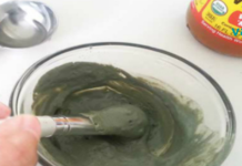 ვაშლის ძმარი და მწვანე თიხა ჰემოროიდების წინააღმდეგ! უნდა სცადოთ და განკურნოთ ანალური სისხლძარღვები!