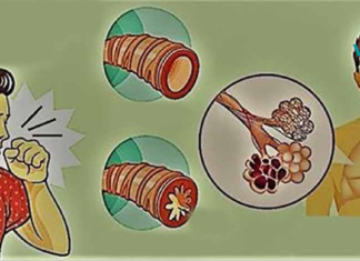 საკვები, რომელიც უნდა მიირთვათ არტერიების სისუფთავის შესანარჩუნებლად!!