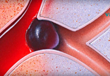 როგორ გავათხელოთ სხეულში სისხლი?! უდაოდ საჭირო ინფორმაციაა