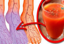 დიახ, თქვენ შეგიძლიათ გააუმჯობესოთ სისხლის ცუდი მიმოქცევა და ცივი ფეხები!!