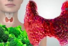 5 საკვები, რომელიც არ უნდა მიირთვათ, თუ ფარისებრი ჯირკვლის პრობლემა გაწუხებთ