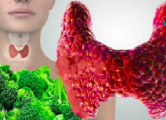 5 საკვები, რომელიც არ უნდა მიირთვათ, თუ ფარისებრი ჯირკვლის პრობლემა გაწუხებთ