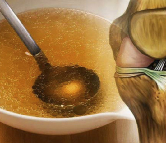 გააახალგაზრდავეთ თქვენი მუხლები, მყესები და სახსრები ამ წარმოუდგენელი რეცეპტით, რომელიც უკეთესად აღადგენს და აძლიერებს მათ, ვიდრე სხვა რამეები!