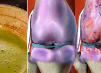 ეს მცენარეული ნარევი გამოიყენება რევმატიზმის, ართრიტისა და ნებისმიერი ძლიერი ტკივილის სამკურნალოდ. ძალიან სწრაფად ხსნის ტკივილს..