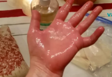 წაისვით ეს ზეთი ტკივილის მყისიერად შემსუბუქებისთვის! ართრიტის, იშხიაზის ან ზურგის ტკივილის მქონე ადამიანებისთვის ეს საუკეთესო საშუალებაა!