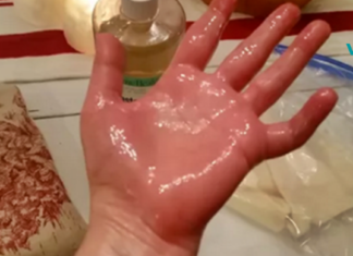 წაისვით ეს ზეთი ტკივილის მყისიერად შემსუბუქებისთვის! ართრიტის, იშხიაზის ან ზურგის ტკივილის მქონე ადამიანებისთვის ეს საუკეთესო საშუალებაა!