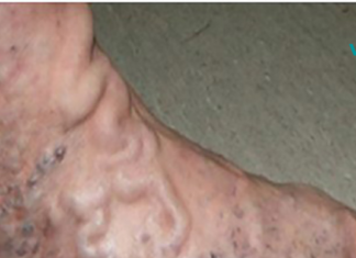 ქოქოსის ზეთი დაგეხმარებათ 10 წლით ახალგაზრდულად გამოიყურებოდეთ. გამოიყენეთ ეს საშუალება 2 კვირის განმავლობაში!