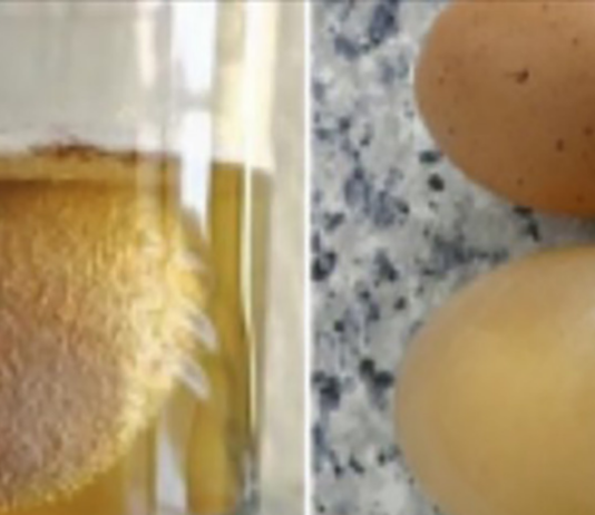 ეს საშუალება მოგიხსნით ძვლებისა და სახსრების პრობლემებს, რომლებიც სავარაუდოდ წლებია გაწუხებთ..!