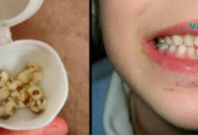 გაიგეთ მეტი, თუ რატომ უნდა შეინახოთ თქვენი შვილების სარძევე კბილები!