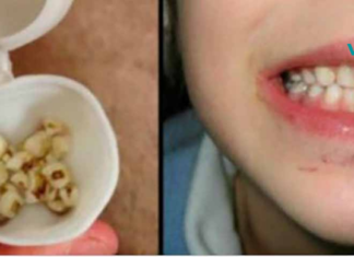 გაიგეთ მეტი, თუ რატომ უნდა შეინახოთ თქვენი შვილების სარძევე კბილები!