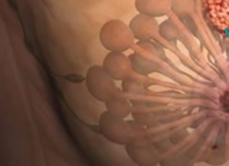 პროდუქტმა, რომელსაც ჩვენ ყოველდღიურად ვიყენებთ, შესაძლოა გამოიწვიოს ძუძუს სერიოზულ პრობლემები!! იცოდით ამის შესახებ?!..