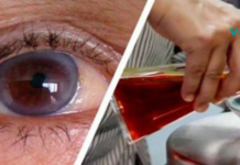 გადაყარეთ მედიკამენტები! მხოლოდ ამ ერთი ინგრედიენტის გამოყენება დაგეხმარებათ მხედველობის გაუმჯობესებაში 97%-ით!