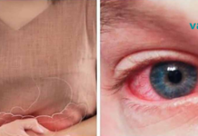 თეთრ ფქვილთან დაკავშირებული ჯანმრთელობის 7 რისკი!