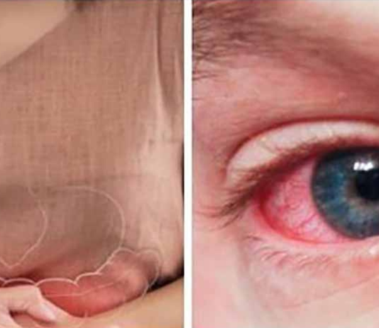 თეთრ ფქვილთან დაკავშირებული ჯანმრთელობის 7 რისკი!