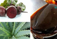 3 ბუნებრივი საშუალება, რომელიც დაგეხმარებათ საკვერცხის ცისტების აღმოფხვრაში!