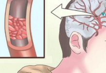 საშუალება რომელიც ეფექტურად გამოიყენება წონის კონტროლის პროცესშიც.. საცხობი სოდის გამოყენების სწორი გზა!!