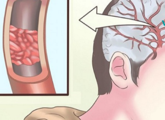 საშუალება რომელიც ეფექტურად გამოიყენება წონის კონტროლის პროცესშიც.. საცხობი სოდის გამოყენების სწორი გზა!!