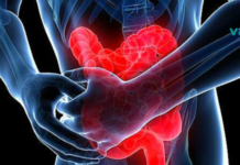 5 ნიშანი იმისა, რომ შესაძლოა თქვენი ნაწლავები არაჯანსაღად ფუნქციონირებდეს..