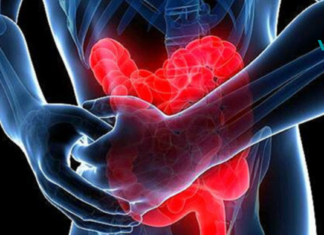 5 ნიშანი იმისა, რომ შესაძლოა თქვენი ნაწლავები არაჯანსაღად ფუნქციონირებდეს..