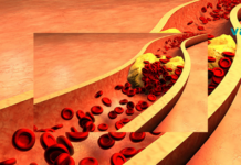 მიიღეთ ამ სასმელის 4 სუფრის კოვზი ყოველ დილით და დაემშვიდობეთ დაბლოკილ არტერიებს, არტერიულ მაღალ წნევას და ცუდ ქოლესტერინს!