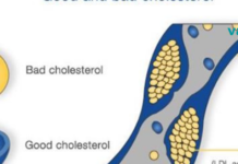 როგორ მოქმედებს ქოქოსის ზეთი ქოლესტერინზე და წონის კლებაზე ?!.. საოცარია