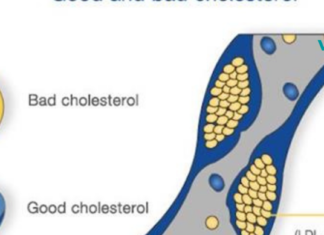 როგორ მოქმედებს ქოქოსის ზეთი ქოლესტერინზე და წონის კლებაზე ?!.. საოცარია