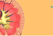 8 ყველაზე გავრცელებული ცუდი ჩვევა, რომელიც აზიანებს თირკმლებს!