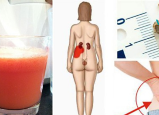 როგორ მოვამზადოთ ყველაზე ძლიერი წვენი, რომელიც ბუნებრივად აშორებს თირკმელებში კენჭებს!