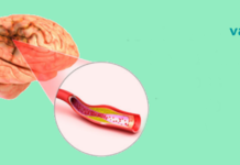 6 ყველაზე ცუდი ჩვევა, რომელიც აზიანებს თქვენს ტვინს და რომელსაც უნდა მოერიდოთ!