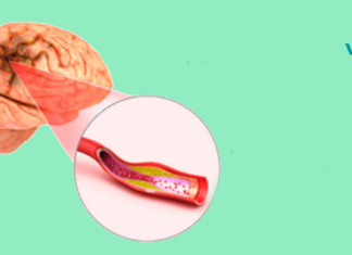 6 ყველაზე ცუდი ჩვევა, რომელიც აზიანებს თქვენს ტვინს და რომელსაც უნდა მოერიდოთ!