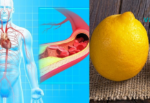 დღესაც კი არტერიების გასუფთავება ნიორისა და ლიმონის დახმარებით საუკეთესო მეთოდად ითვლება!!.. ყველაზე ეფექტური საშუალება!