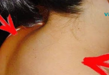 ამ პიროვნებას მარილები დაუგროვდა კისერზე… წაიკითხეთ ეს სტატია და მისი დახმარებით მოიშორეთ ტკივილები!